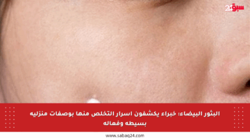 البثور البيضاء: خبراء يكشفون أسرار التخلص منها بوصفات منزلية بسيطة وفعالة